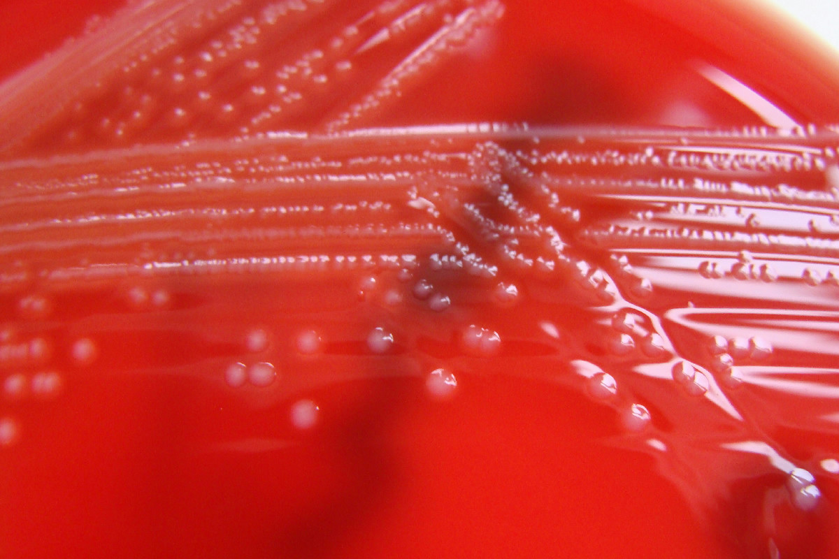 Cosa rischi davvero trattando male i surgelati: intossicazioni e gravi problemi in casa